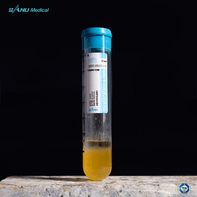Alivie causam dor ao tubo de ensaio 20ml ACD-A de PRP com o GEL para o tratamento do OA